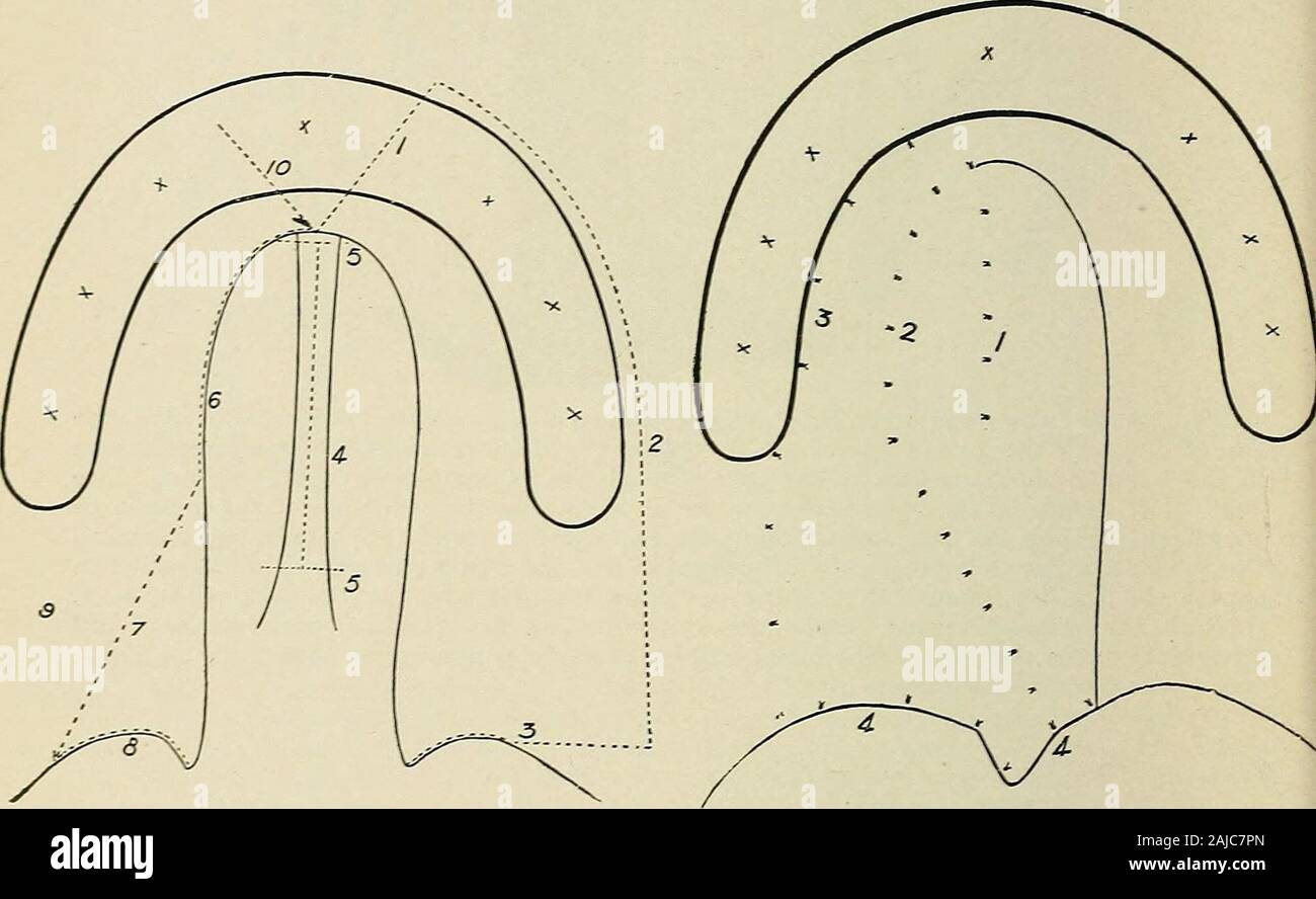 Plastic surgery; its principles and practice . Fig. 255. Fig. 256 ...