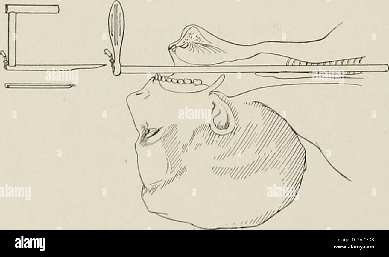 Surgical treatment; a practical treatise on the therapy of surgical