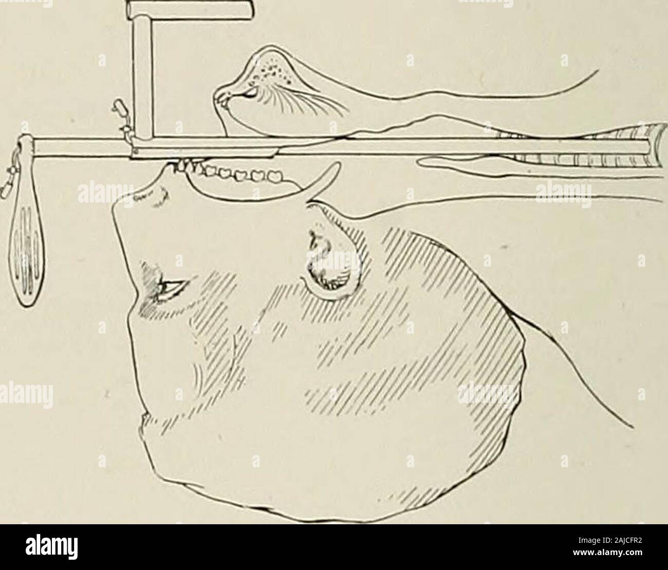 Surgical treatment; a practical treatise on the therapy of surgical