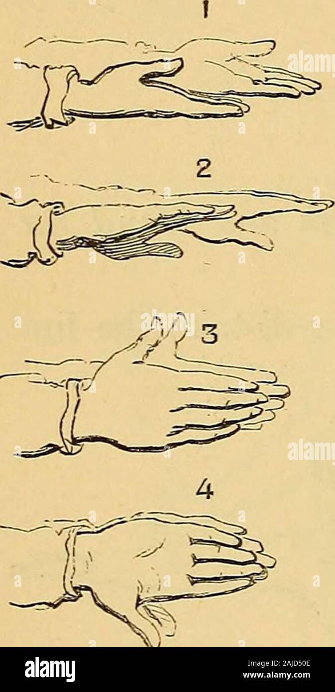 Hand-book of calisthenics and gymnastics : a complete drill-book for schools, families, and gymnasiums : with music to accompany the exercises . d that the palms shall be up on both odd and even numbers, differingonly from Fig. 40 at the termination of the motion from the com-mencing position, in having the arms extended sidewise. No. 92.—Third Movements—Reciprocate. At this command,from the position of Fig. 38, the trunk vibrates from side to side,bending as much as possible, with the legs kept straight, first to theright and then to the left, eight times for each of the four modes ofholding Stock Photo
