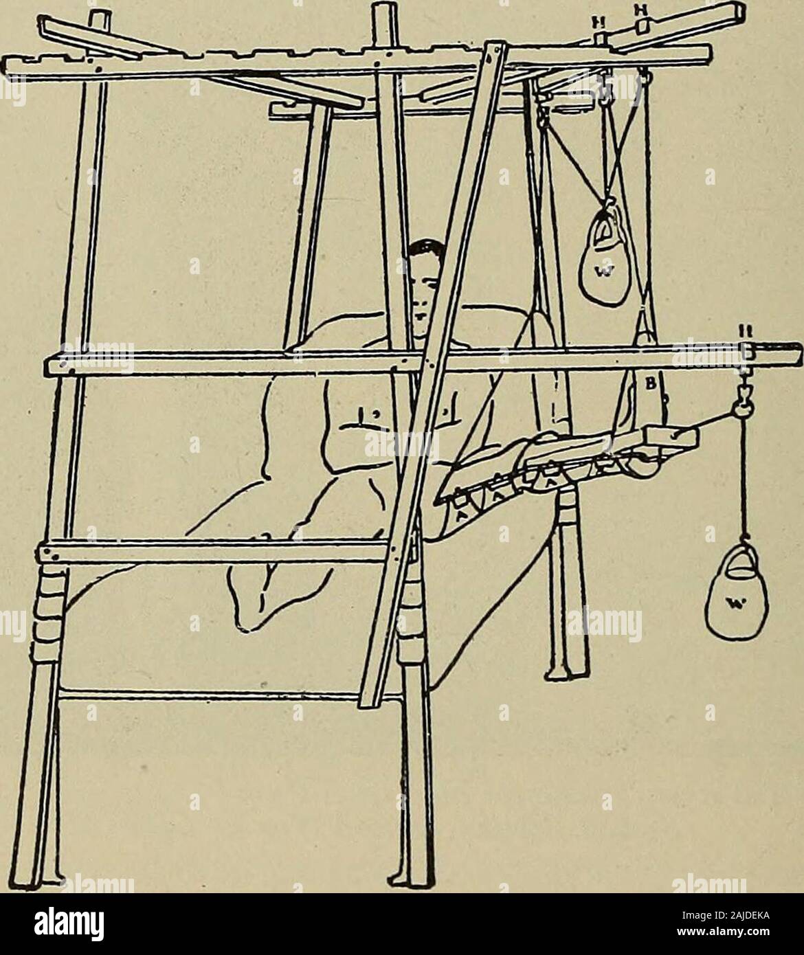 Industrial Medicine And Surgery Nal Frame Connecting Bars 8 Ft 8 In The Head And Foot Frames Are Set Up And Attached To The Bedwith Rope They Are Then Joined By Industrial Medicine And Surgery Nal Frame Connecting Bars 8 Ft 8 In The Head And Foot Frames Are Set Up And Attached To The Bedwith Rope They Are Then Joined By