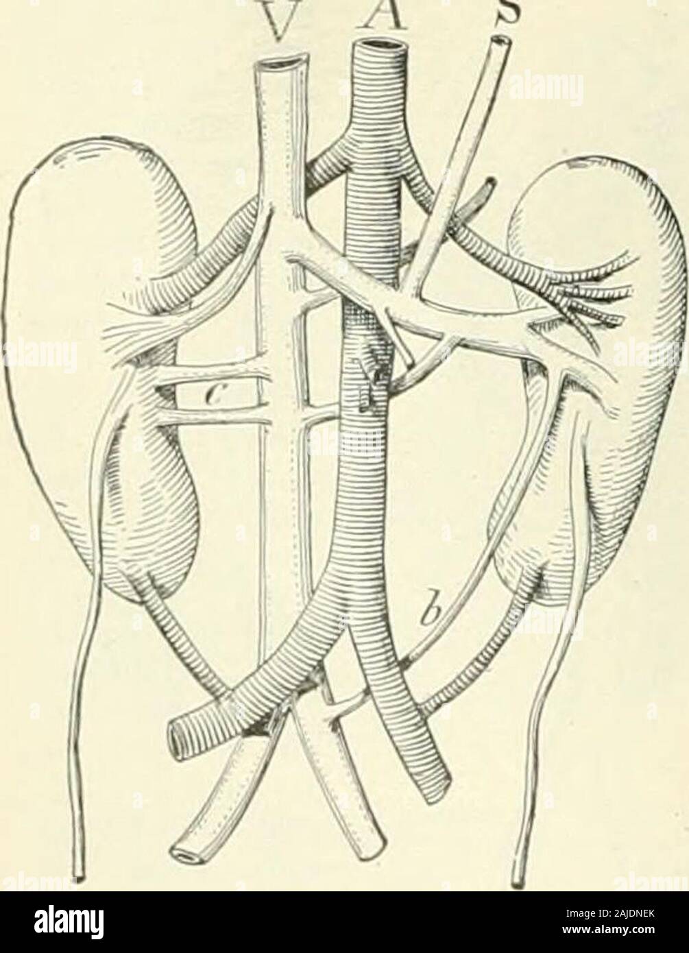 A Reference handbook of the medical sciences embracing the entire range of scientific and practical medicine and allied science . externaliliacsand a common iliac formed by the junction of the twointernal iliacs; this arrangement is .seen in some of thelower animals, as the bear, etc. The vena cava inferioris occasionally foimed by a common iliac vein and the veins of thej ;S other side, not opening by acommon trunk,but separately.Renal VeiriK.—The left renalvein, in order toreach the in-ferior cava, maypass liehind in-stead of in frontof the aorta.Supernumeraryrenal veins arenot so commonas Stock Photo
