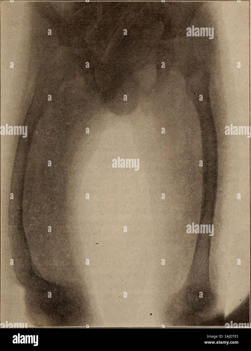 Albany medical annals . Lymph nodes No enlarged lymph nodes are