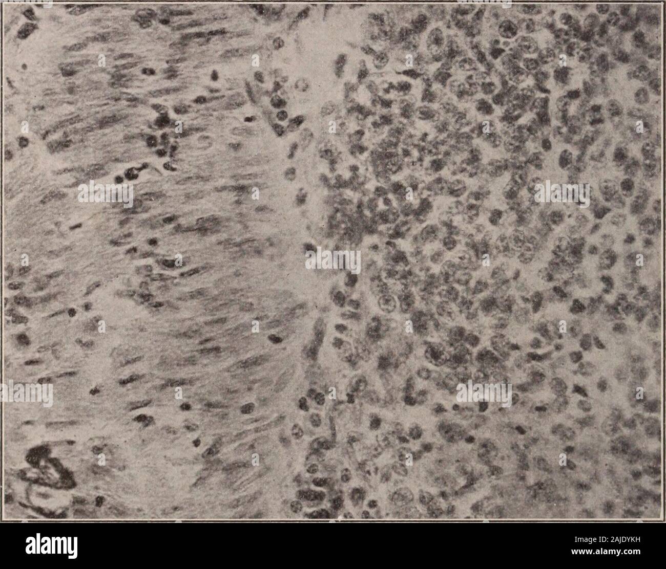 Metaplasia hires stock photography and images Alamy