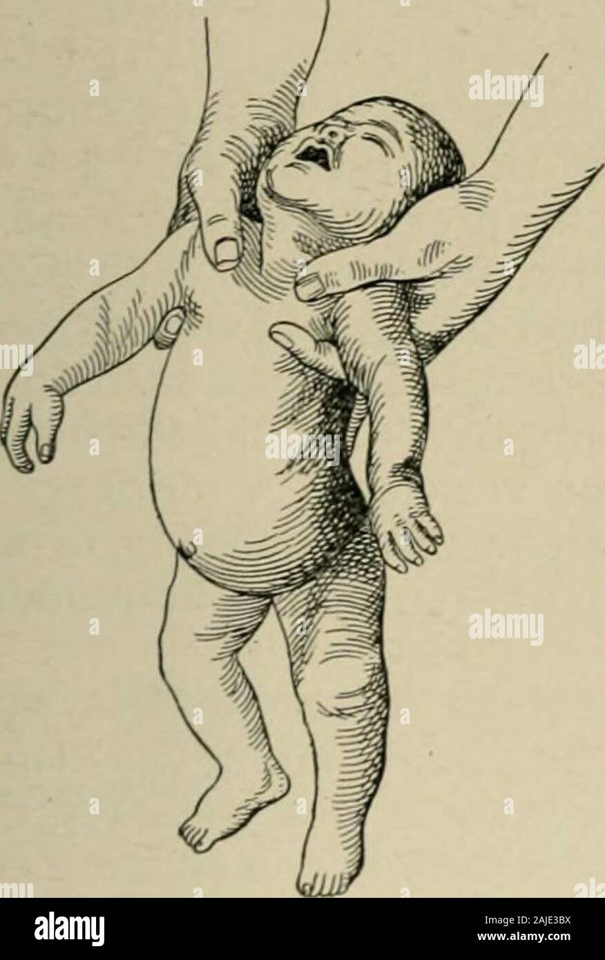 Neonatorum hires stock photography and images Alamy