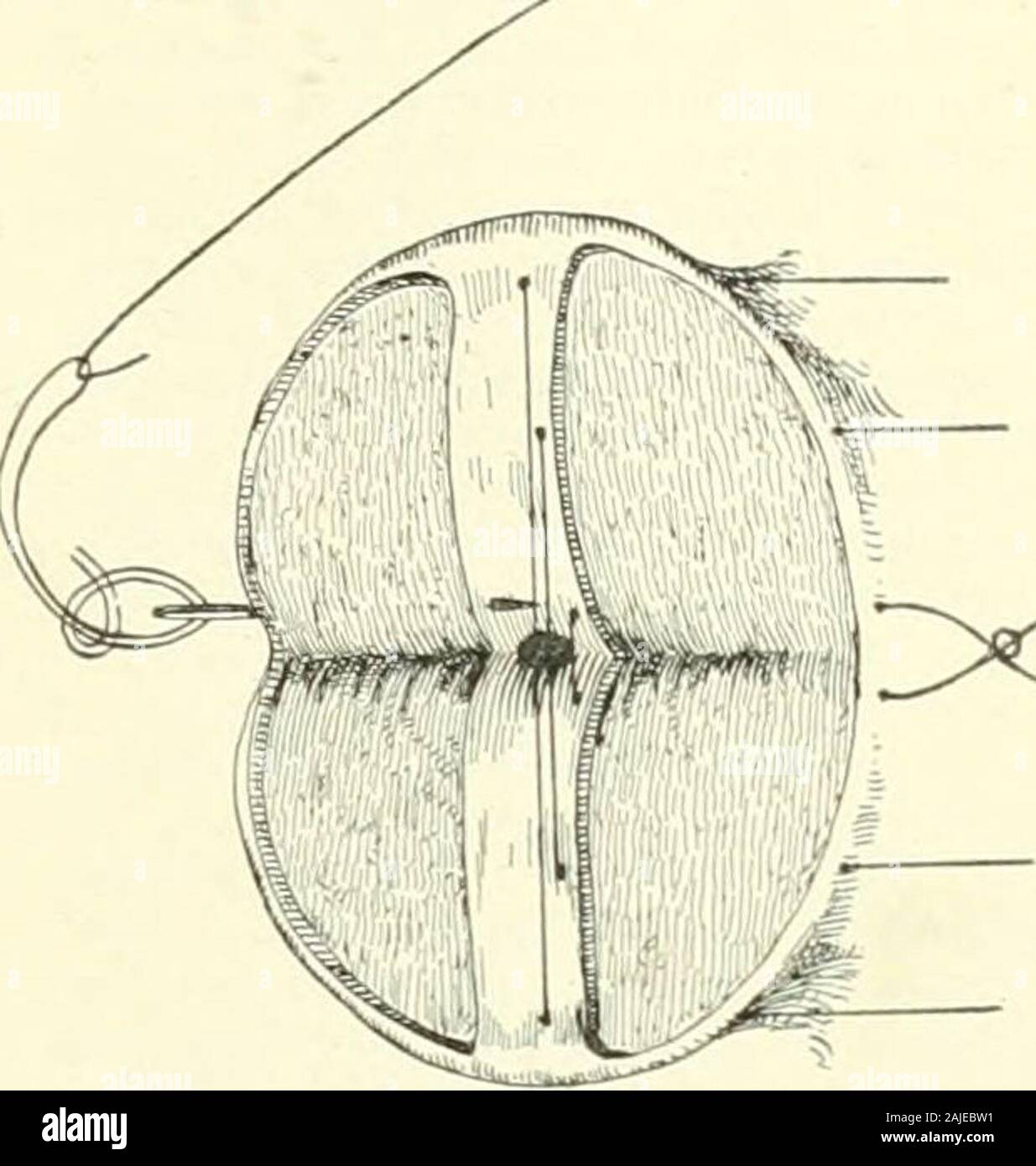 A Reference handbook of the medical sciences embracing the entire range of scientific and practical medicine and allied science . Fig. 4880.—Denuding the Cervix. the test of time and is applicable to most cases, althoughin atypical lacerations modifications must be introducedto suit the requirements. The operation is performed either in the Sims or in thelithotomy position. The bowels should be thoroughly. fi^^fr^i L---^^ Fig. 4881.—Sutures in Position. moved the day before, and on the morning of the opera-tion an enema should be given at least two hours beforethe time set for oi)eration. The Stock Photo