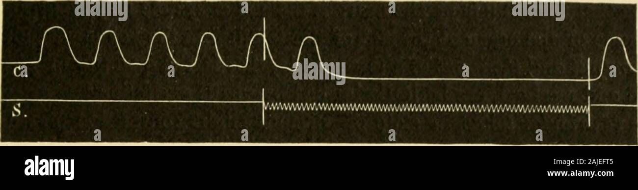 An American text-book of physiology . th the heart stimulated. The heart was arrested as before. Thus the fundamental fact of the inhibition of a peripheral motor mechan-ism by the central nervous system through the agency of si)ecial inhibitory 1 Bever and von Bezold, 1867, pp. 236, 247. Ludwig and Thiry, 1864, p. 429; Bever, 1867, p. 249. ^ It is probable tliat the fibres of spinal origin end in the sympathetic ganglia, making con-tacts there with sympathetic ganglion-cells, the axis-cylinder processes of which pass up thecervical chain and descend to the heart in company with the vagus. * G Stock Photo