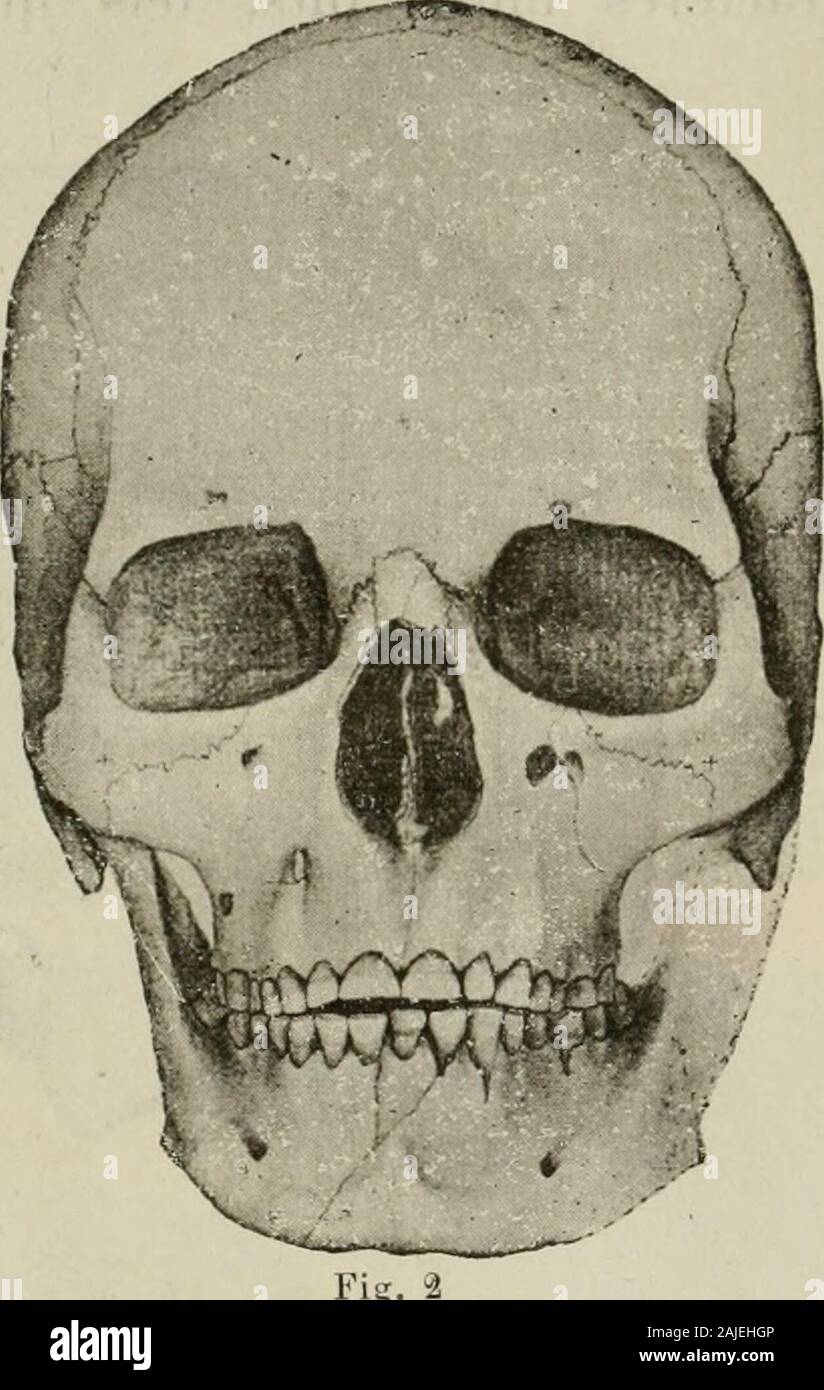 ardoise synthétique