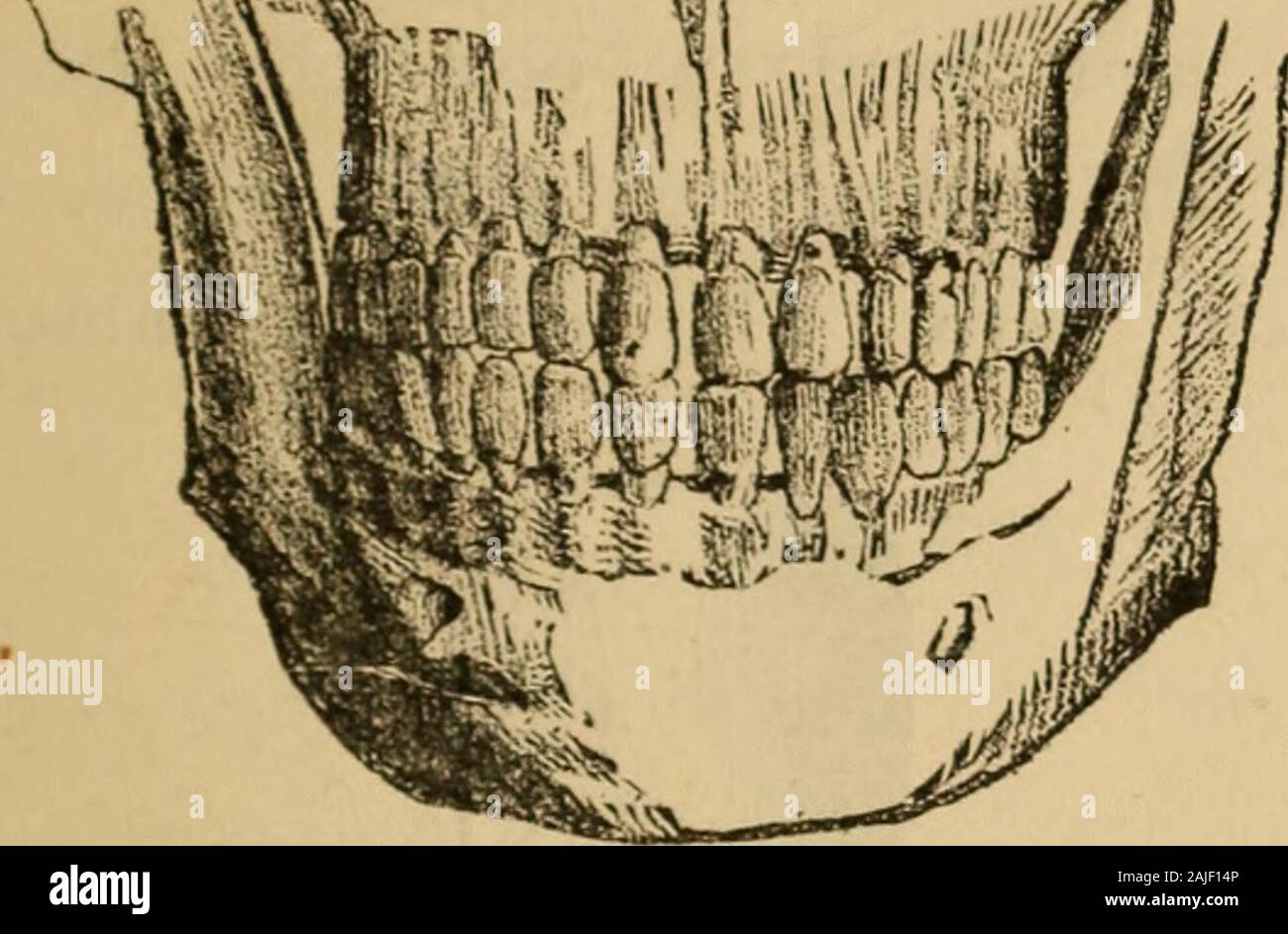 Chisel shaped teeth hires stock photography and images Alamy