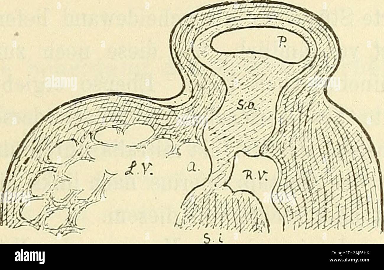 Anatomie menschlicher Embryonen . 109. Herz vom Embryo Pr. Die Vorderwand von innen her gesehen.Constr. Vergr. 32. chem der Sulcus aorticus und der Sulcus pulmonalis, durch das linkeSeptum aorticum geschieden, herabsteigen. Furche und Leiste biegenmedialwärts um, der Sulcus aorticus leitet gegen den Einschnitt derunteren Scheidewand, die Leiste gegen diese selbst. Bei der auf Seite 158 mitgetheilten Zeichnung vom Embryo •.^(Fig. 106j ist das Septum intermedium bereits bis an die Ventrikel-grenze vorgedrungen, auch hier verfolgt man das untere Auslaufendes Sulcus aorticus gegen das Ostium inter Stock Photo