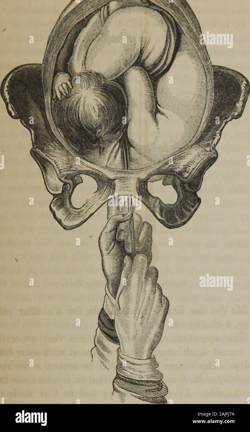Evisceration hi-res stock photography and images - Alamy