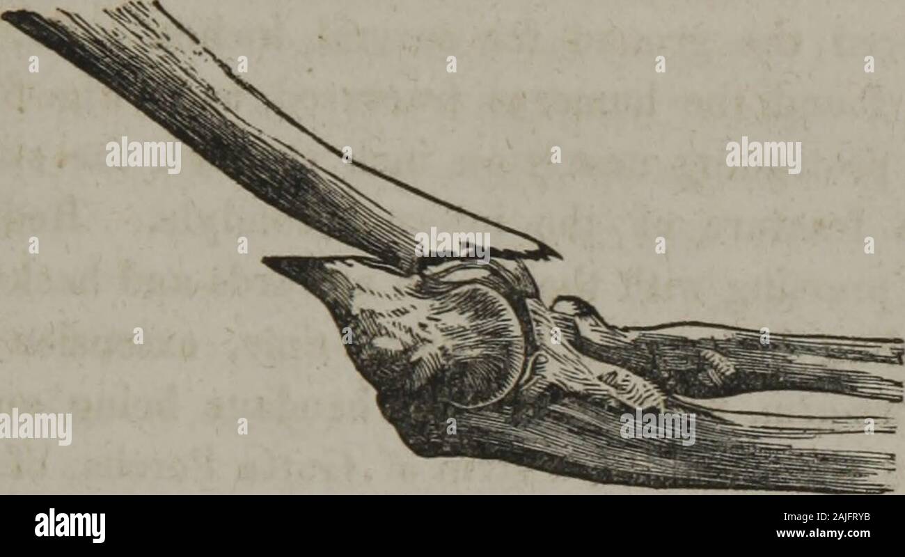 Gum shellac hi-res stock photography and images - Alamy