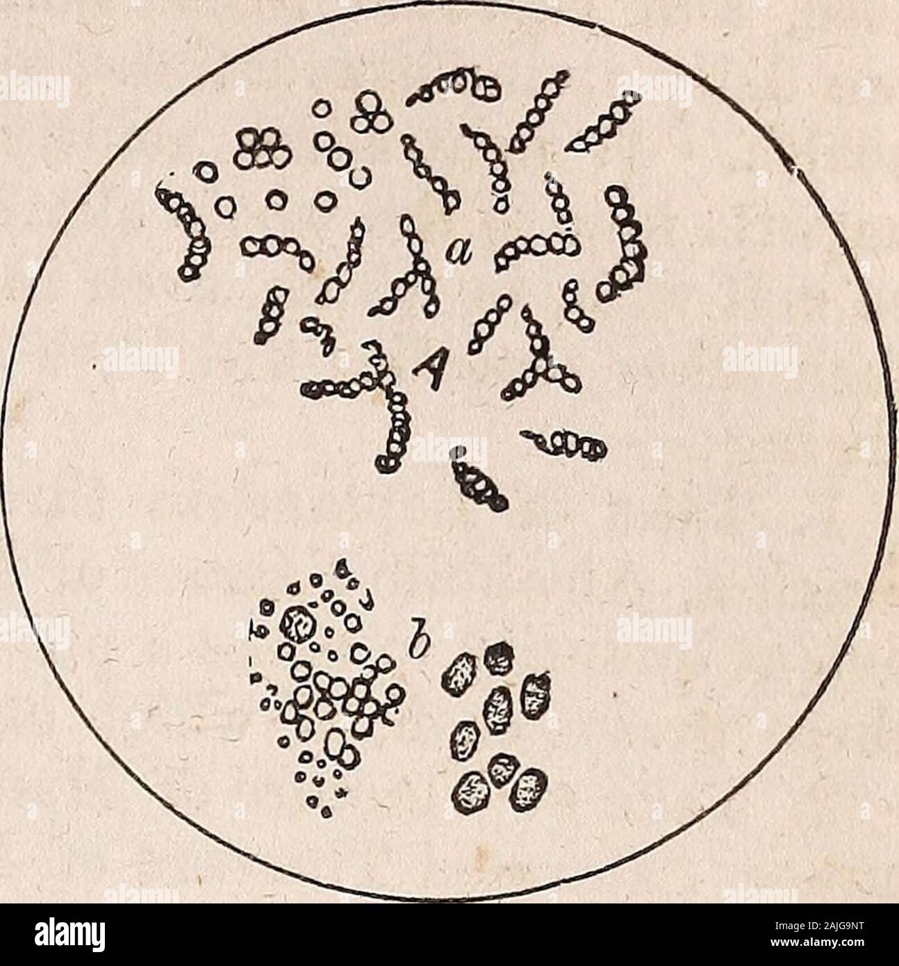 The American family physician : or, Domestic guide to health : for the use of physicians, families, plantations, ships, travelers, etc. . a. Crystals of uric acid, squares or DYSPEPSIA. 399 Fig. 27.. Fig. 28. Causes. One of the most common causesof dyspepsia is hasty and imperfect mastica-tion of food with want of exercise. To insurehealth, both the mind and body should beproperly and regularly exercised, with ap-propriate intervals of rest or recreation. Dys-pepsia is especially common to those who eathastily and in large quantity, as among mer-chants, travelers, and hotel boarders. It mayals Stock Photo