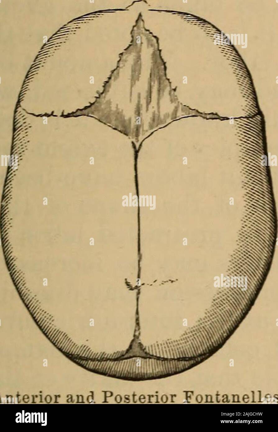 A treatise on the science and practice of midwifery . rietal bones on either side. The fontanelles(Fig. 60) are the membranous interspaces where the sutures join—?the anterior and larger being lozenge-shaped, and formed by the junc-tion of the frontal, sagittal, and two halves of the coronal sutures.It will be well to note that there are, therefore, four lines of suturesrunning into it, and four angles, of which the anterior, formed bythe frontal suture, is most elongated and well marked. The posteriorfontanelle (Fig. 61) is formed by the junction of the sagittal suturewith the two legs of the Stock Photo