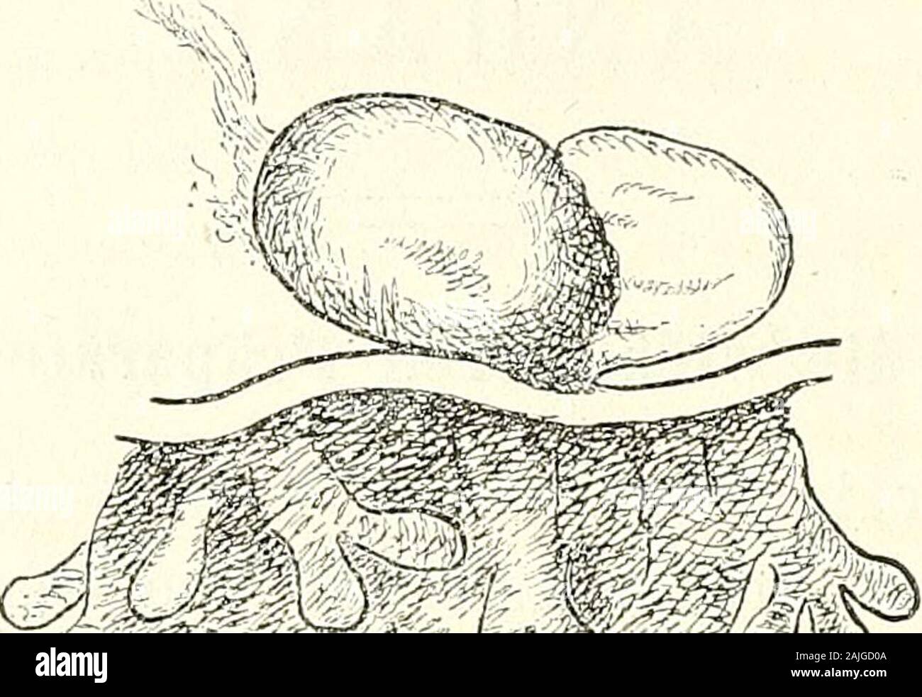 Anatomie menschlicher Embryonen . e sich gleichfalls als hohl documen-tirt, misst im grösseren Durchmesser 0.85 mm, senkrecht darauf0,6. Die durchsichtige Blase umfasst mit ihrem Rande das eineEnde des Elhpsoides. Die Verbindung mit dem Chorion wird durcheinen sehr kurzen Stiel vermittelt, der sowohl mit dem Ellipsoid alsmit der Blase in Verbindung steht. Wie schon oben S. 32 angegebenworden ist, so halte ich die Blase für das Amnion, das Ellipsoidfür die Nabelblase nebst Embryonalanlage und zwar muss die letz-tere an dem vom Amnion überwölbten Theil des EUipsoids, d. h. 88 Anhang. also quer z Stock Photo