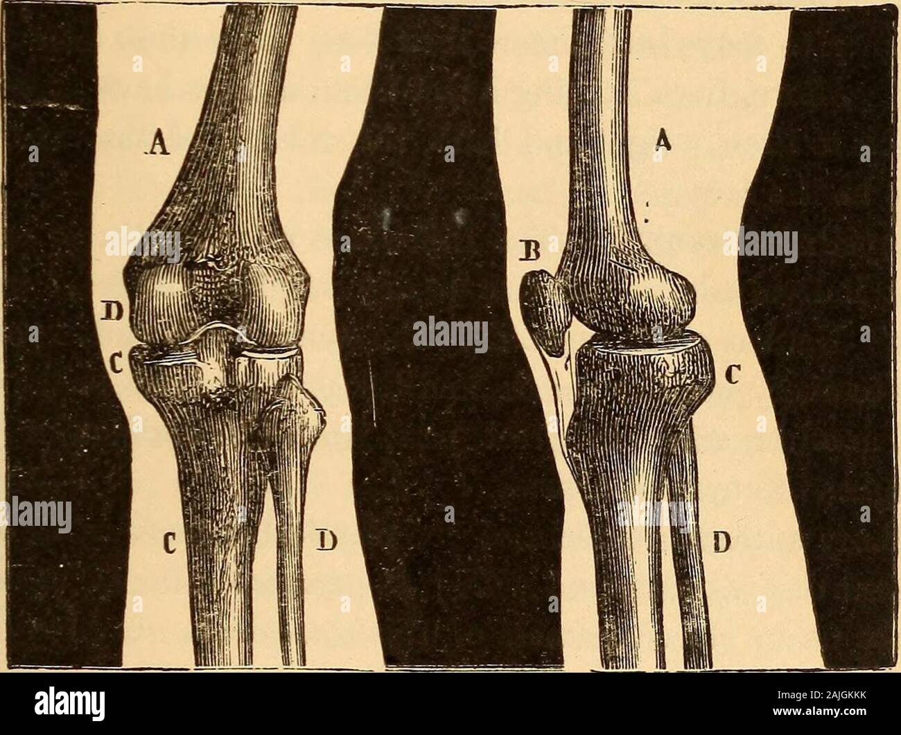 A Treatise On Physiology And Hygiene For Educational Institutions And General Readers Fig 13 Lower Portion Of The Leg 5 What Are The Tendons Or Sinews Their Strength Color Location Tendon