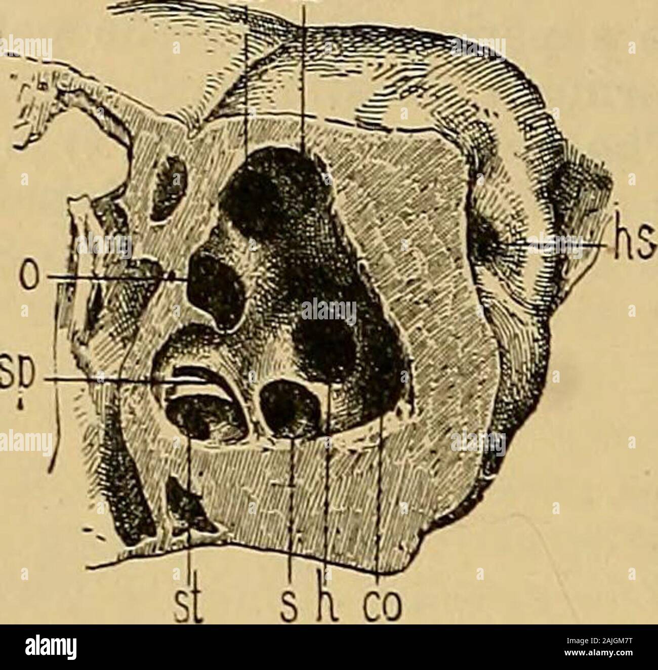 A text-book of the diseases of the ear for students and practitioners . preparationsthe cavity of the cochlea communicates with the vestibule by a spaciousopening (Fig. 303, v), and with the tympanic cavity by means of the roundwindow. With its spiral windings, the cochlea is so embedded in the petrous portionof the temporal bone between the internal meatus and the carotid canal thatits base is turned inwards towards the internal auditory canal and its apex(cupola) outwards towards the tympanic cavity. On vertical sections of the cochlea (Fig. 307), one sees, in addition to theopenings of its Stock Photo