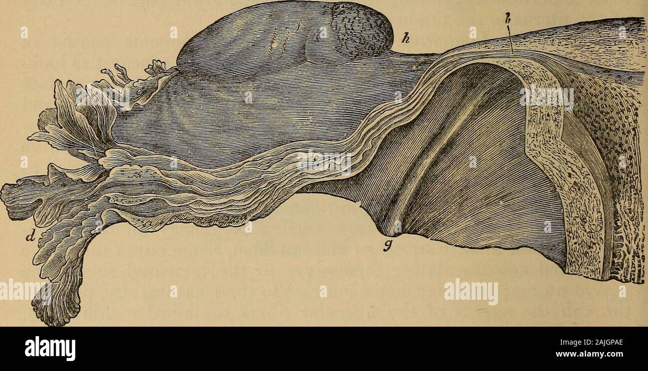 A treatise on the science and practice of midwifery . of the broad ligament, where it may be felt as a hard cord. Itcommences at the uterus by a narrow opening, admitting only thepassage of a bristle, known as the ostium uterinum. As it passesthrough the muscular walls of the uterus the tube takes a somewhatcurved, course, and opens into the uterine cavity by a dilated aper-ture. From its uterine attachment the tube expands gradually untilit terminates in its trumpet-shaped extremity; just before its distalend, however, it again contracts slightly. The ovarian end of thetube is surrounded by a Stock Photo