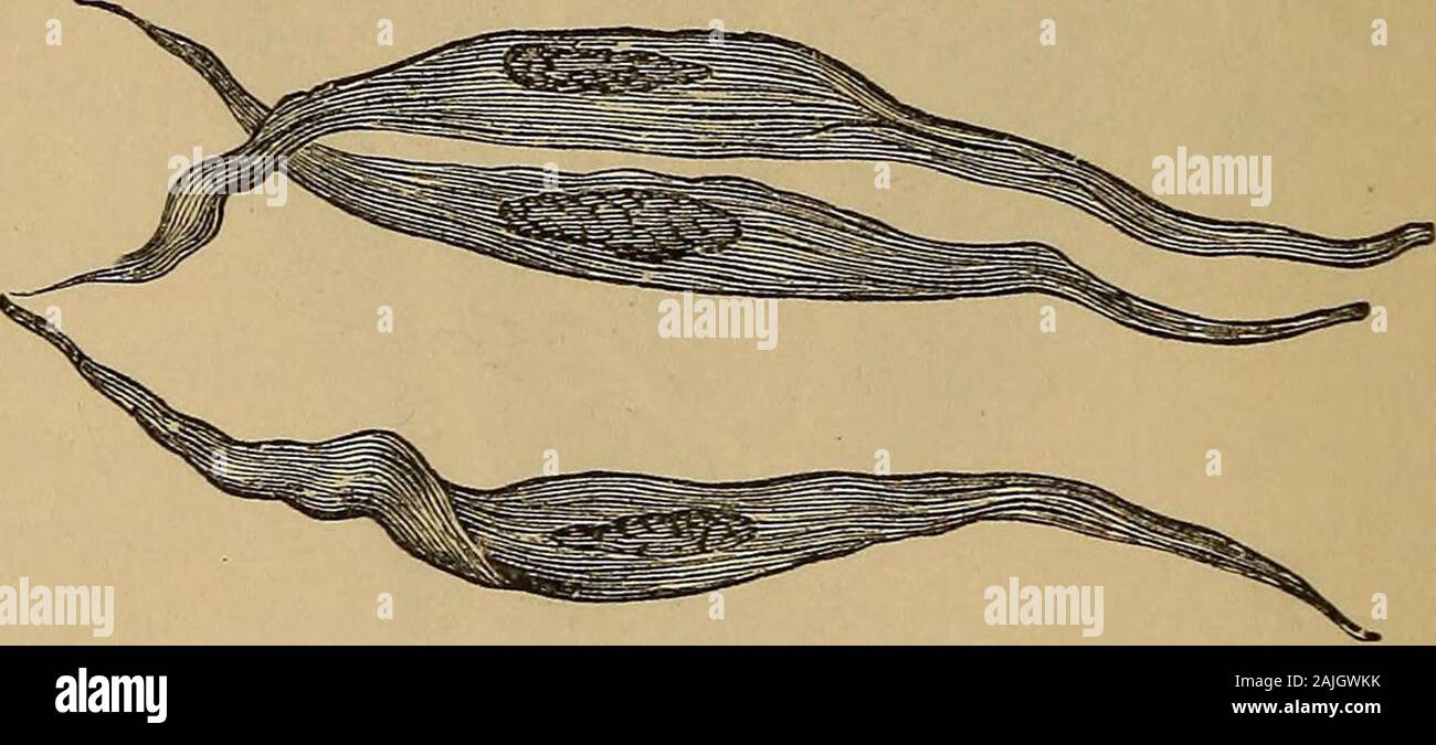A treatise on the science and practice of midwifery . Muscular Fibres of unimpregnated Uterus (After Farre.)a. Fibres united by connective tissue.Separate fibres and elementary corpuscles. Fig. 21.. Developed Mi Gravid Uterus. (After Wagner.) by Dr. Farre2 to be the elementary form of the muscular fibres, andwhich he has traced in various intermediate states of development.Dr. John Williams3 believes that a great part of the muscular tissueof the uterus, rather more indeed than three-fourths of its thickness,is an integral part of the mucous membrane, analogous to the mus-cularis mucosas of th Stock Photo