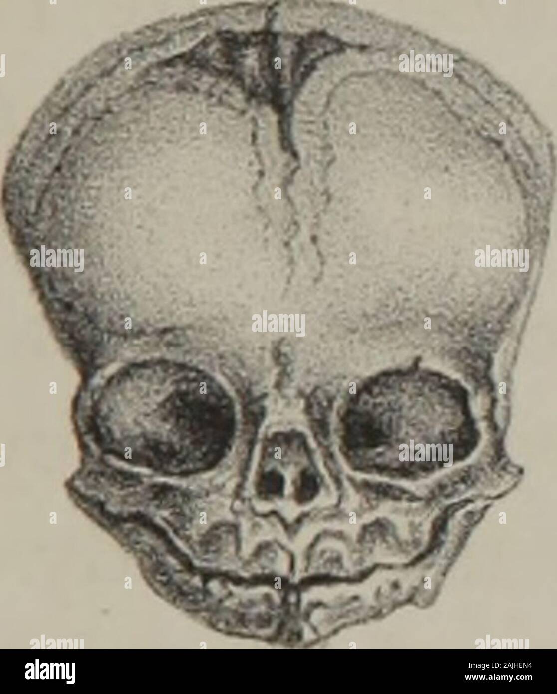 The principles and practice of obstetrics . Mental Extremity. Fig. 33.. Region of Os Frontis. M 34. Stock Photo