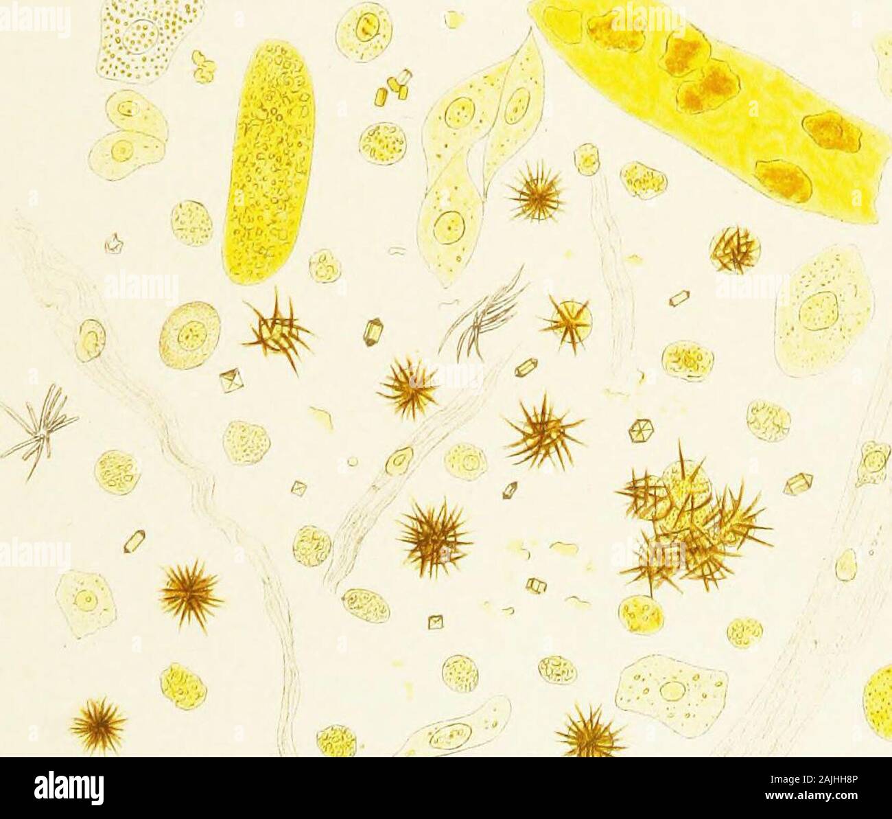 Atlas of urinary sediments; with special reference to their clinical significance . ^ ife. Lilli