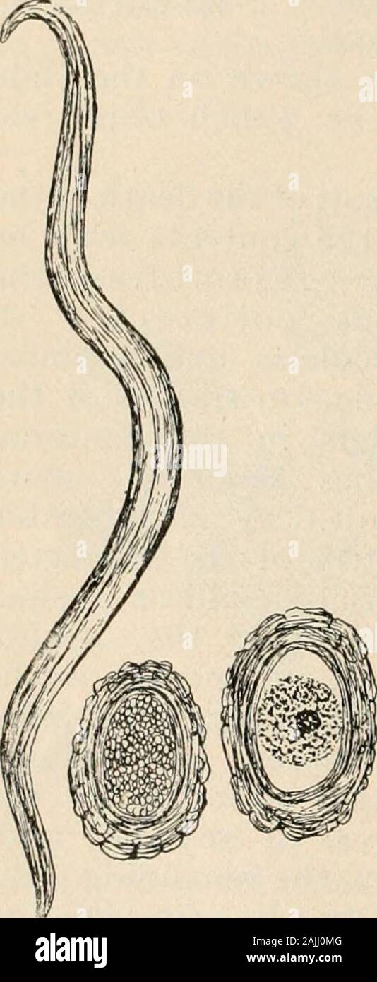 Manual of pathology : including bacteriology, the technic of postmortems, and methods of pathologic research . The Ascaris lumbricoides ^ is a yellowish oryellowish-brown worm, varying in length; thefemale measures about 15 cm. to 30 cm.; themale, 9 cm. to 20 cm. The worm is striatedtransversely and possesses four longitudinal bands. Round worms aremost common in children, occupying the upper portion of the small in-testine, from which they may wander into the bile-ducts, stomach, eso-phagus, nose, Eustachian tube, and larynx. The number in any casevaries; rarely are they present in large numb Stock Photo