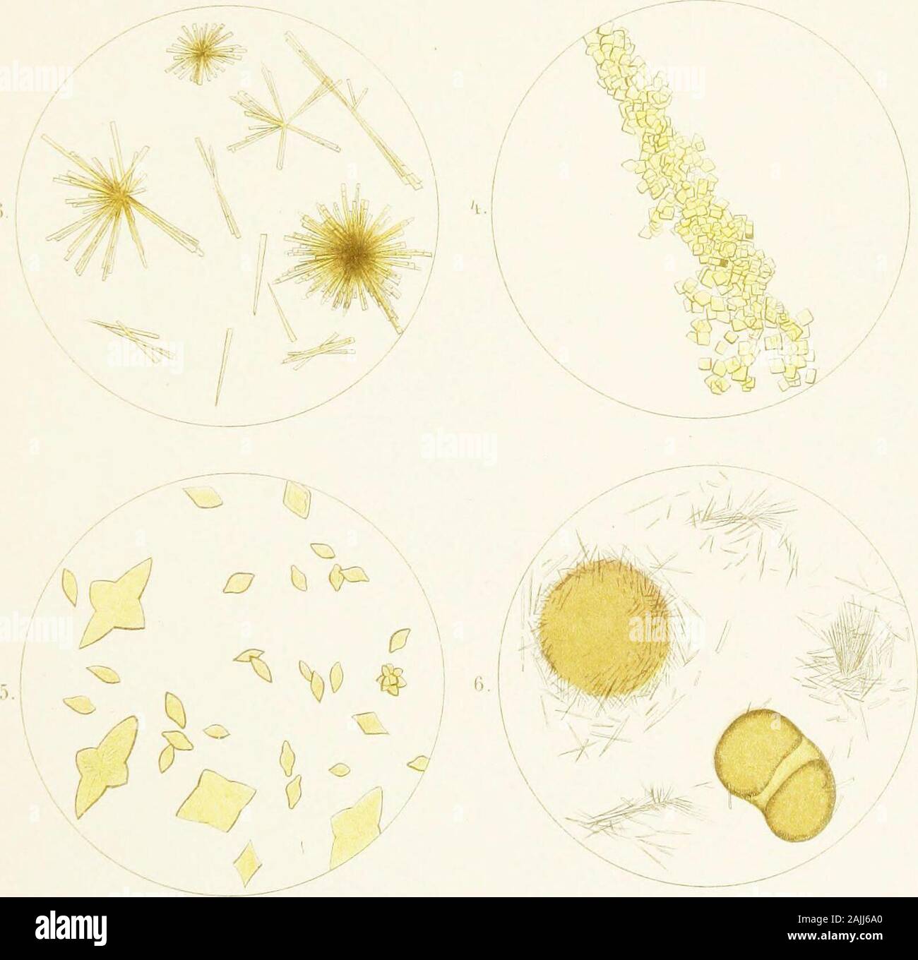 Atlas of urinary sediments; with special reference to their clinical significance . Lith AdSt.JiiliustOiiikharilt.leipjii;. PLATE VII. PLATE VII. Fig. 1. NEEDLES OP ITBIC ACID. Irregularly scattered and arranged intufts ; also numerous granules of AMORPHOUS URATES. [Needlespresenting appearances identical to those represented in this drawinghave been found, by the editor, to give the micro-chemical reactions ofurate of lime.] , From a tophus. Fm. 2. AMORPHOUS URATE GRANULES of pale yellowish colour, aggre-gated in small groups. [Compare with Fig. 6, Plate V.] Fig. 3. ACID AMMONIUM URATE. Small Stock Photo