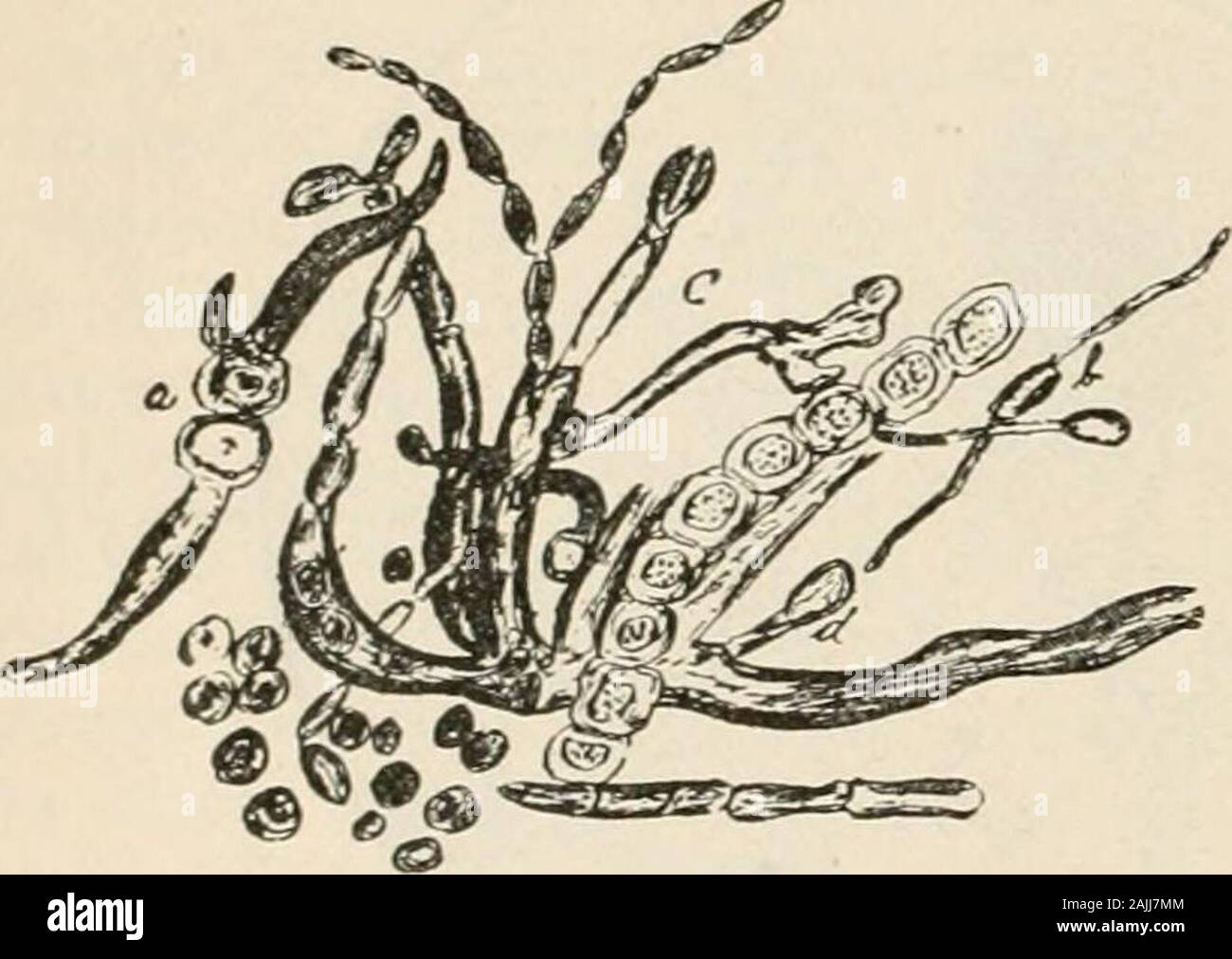 Erythrasma hi-res stock photography and images - Alamy