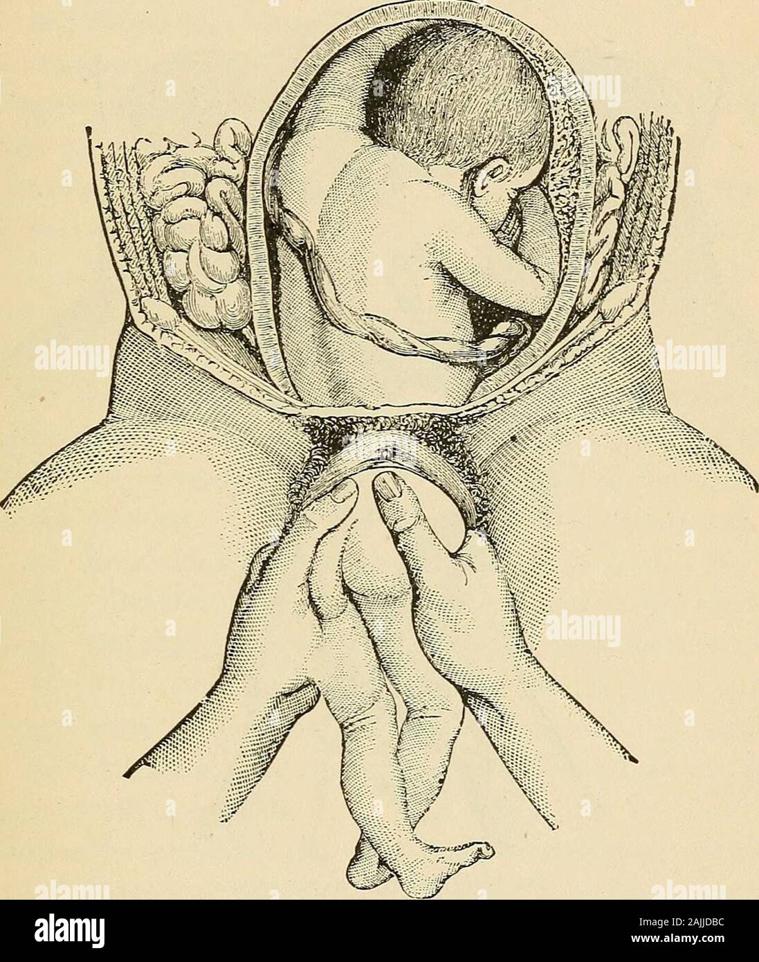 Breech Position Hi Res Stock Photography And Images Page 2 Alamy