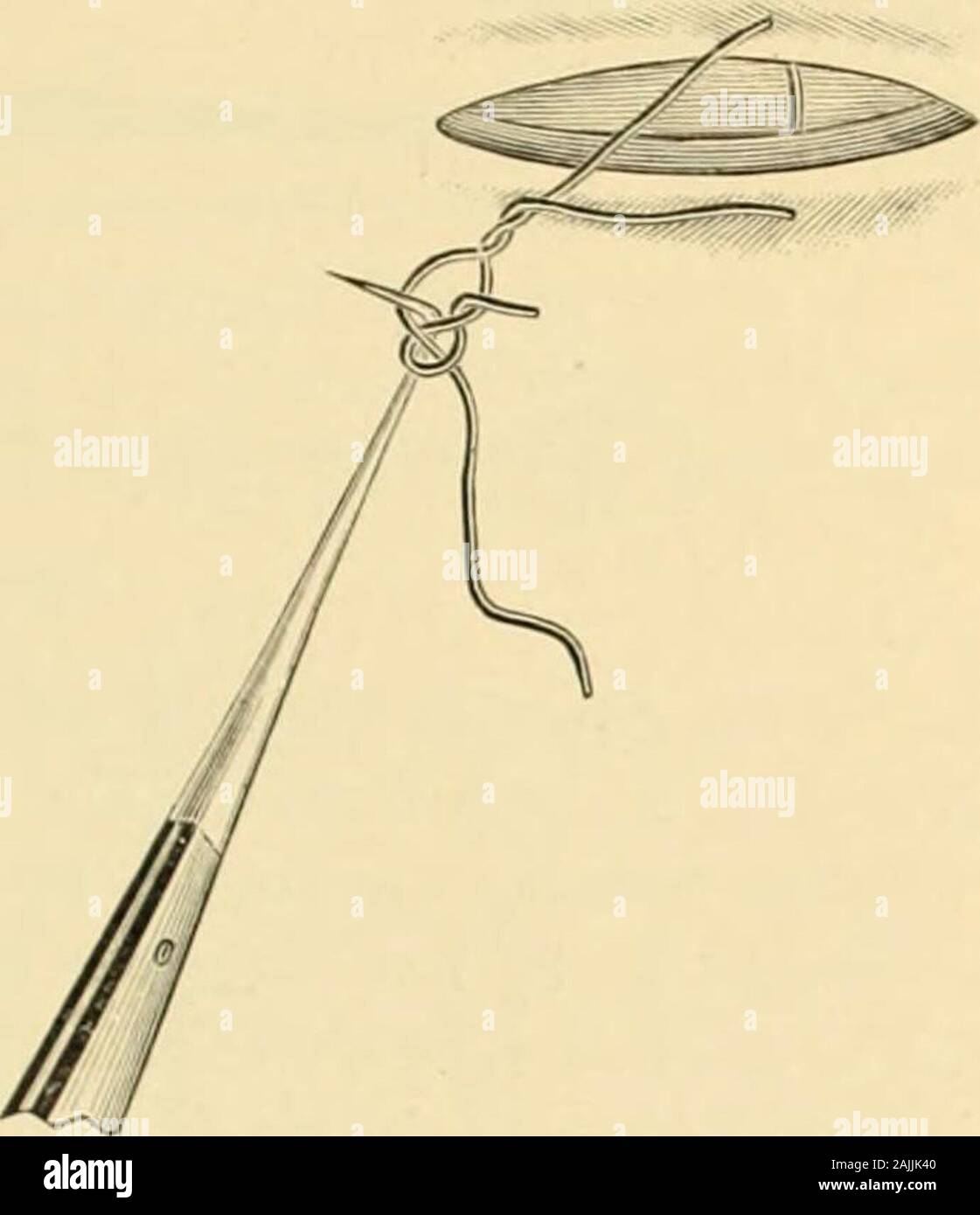 Tenaculum hires stock photography and images Alamy