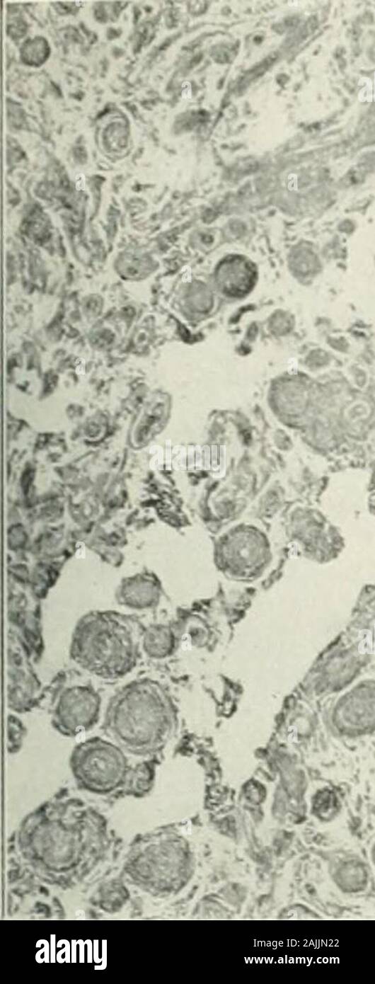 Gelatinous membrane hires stock photography and images Alamy