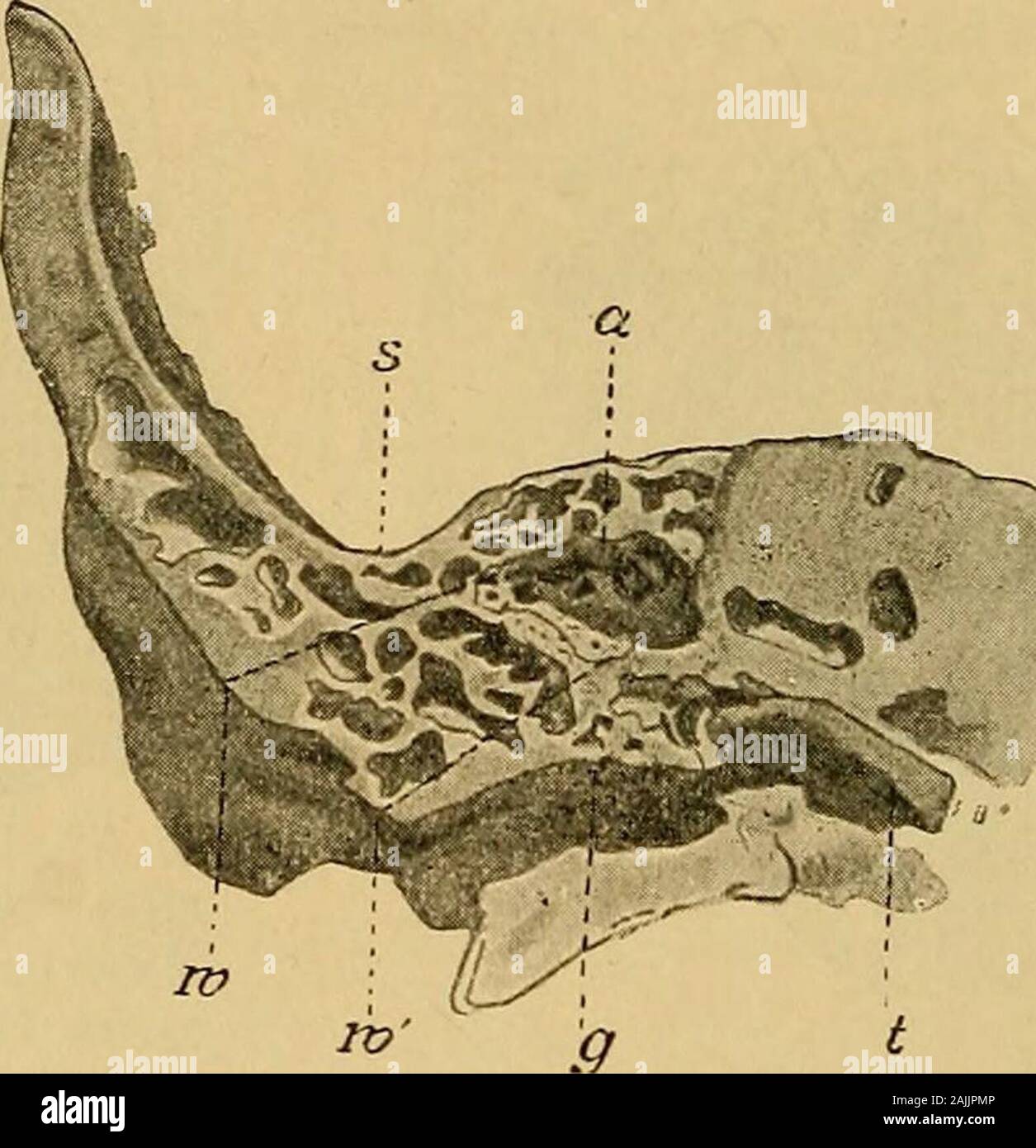 A text-book of the diseases of the ear for students and practitioners . r and a superior. The inferior is that part ofthe mastoid lying on the internal side of its conical portion, and 48 DISEASES OF THE EAR is grooved, in a sagittal direction, by the incisura mastoidea; thisis of variable depth, and serves for the insertion of the digastricmuscle. The osseous wall is frequently as thin as paper at thisplace, and, therefore, abscesses can find a ready outlet in thisdirection (Bezold). The superior is traversed by the windingcourse of the lateral sinus, which originates at the torcularHerophili Stock Photo