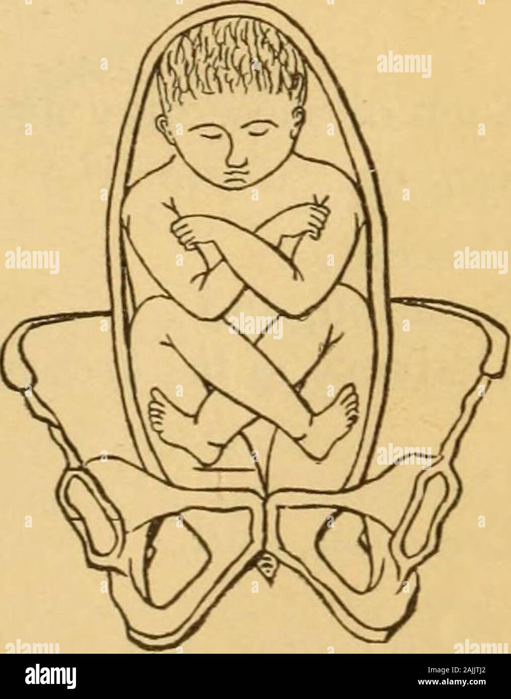 A manual of practical obstetrics . Exceptional Figs. 69, 70, 71, 72, 73, and 74. Six positions of breech presentation. 208 BREECH, KNEE, AND FOOT PRESENTATIONS. Mechanism of Breech Cases.—In complete delivery ofthe child there are here three successive stages to be consid-ered, viz.: 1. Mechanism of the breech. 2. Mechanism of the shoulders. 3. Mechanism of the head. Fig. 75. Stock Photo