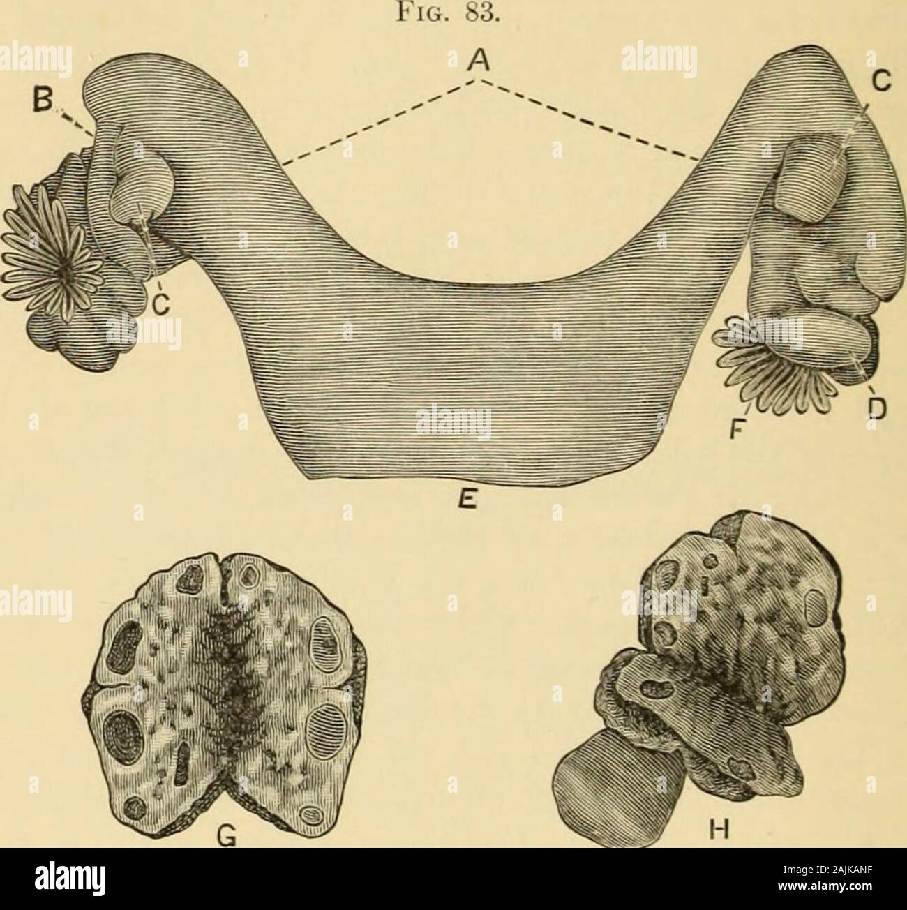 A system of gynecology . e. didelphys), uterus bicornis, and uterus globularis i.e. septus). Uterus bipartitus Mayer, Kussmaul) is by others designated as uterus bifidus. On the other hand, the term bifid is by Playfair [Sciena and Practice of Midwifery, London, 1876, vol. i. p. 13) osed as a synonym of double, and applied to a uterus bicornis unicoUis. Tlie term double uterus is used in very different senses, ami dues not designate anyparticular kind of malformation. It ought only to he used as a general term, eompris-ing the uterus didelphys, the u£ duplex, and the uterus septus. I m. Gyn. T Stock Photo