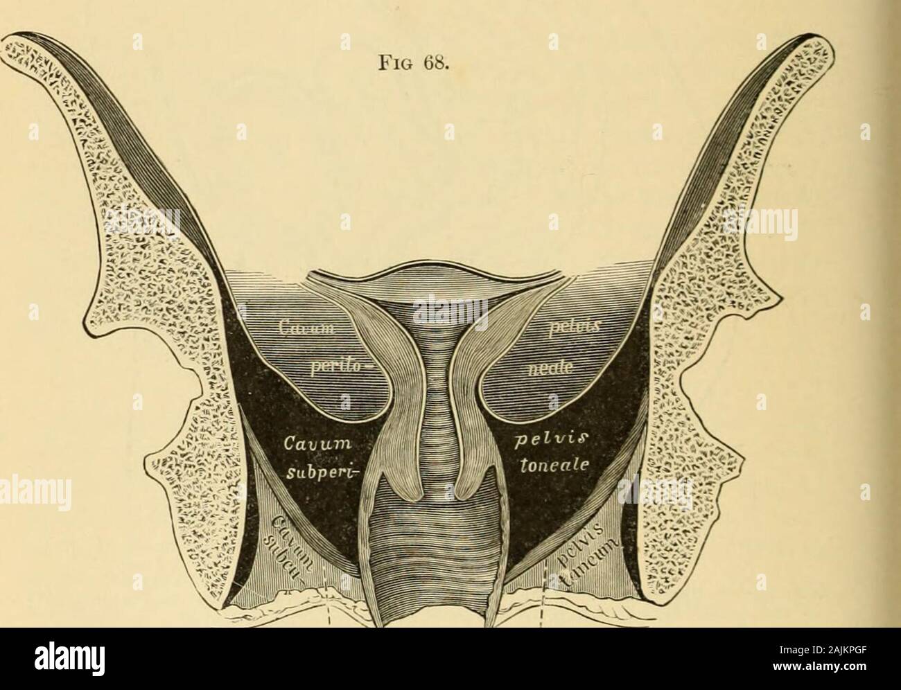 A System Of Gynecology Tuated In The Cavum Pelvis Subperitoneale 