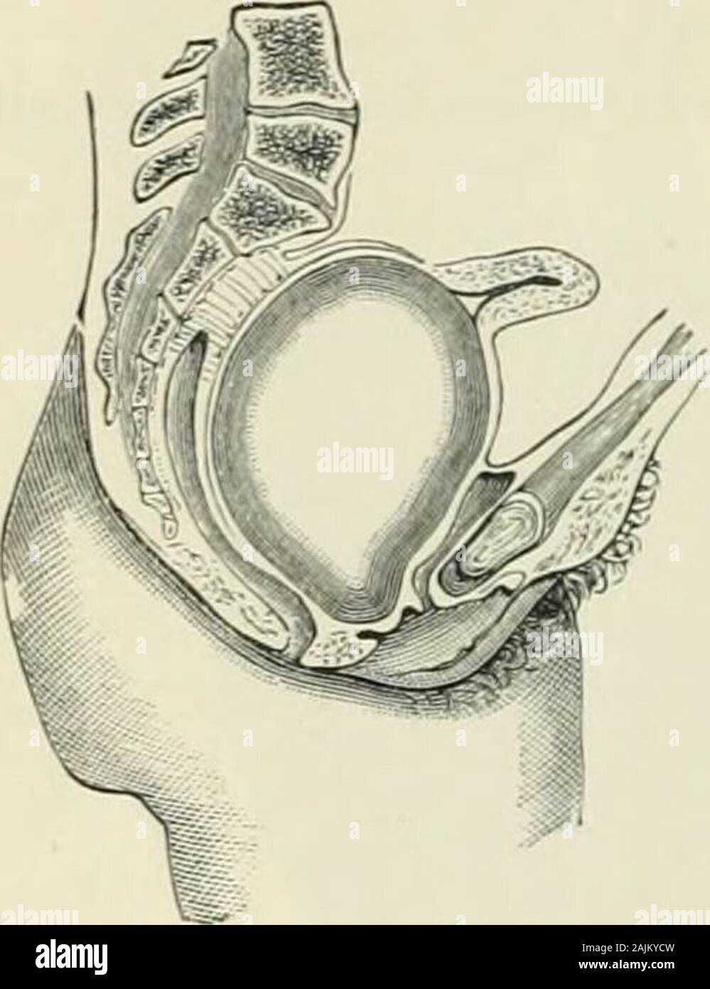 Gynecological Diagnosis And Pathology Hin Recto vaginal Septum Conse gynecological-diagnosis-and-pathology-hin-recto-vaginal-septum-conse