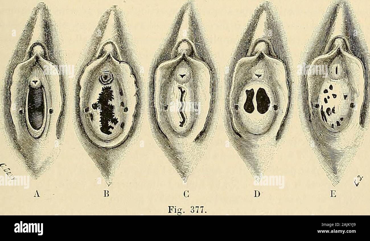 Aspect posterieur hi-res stock photography and images - Alamy, image size:1300x848