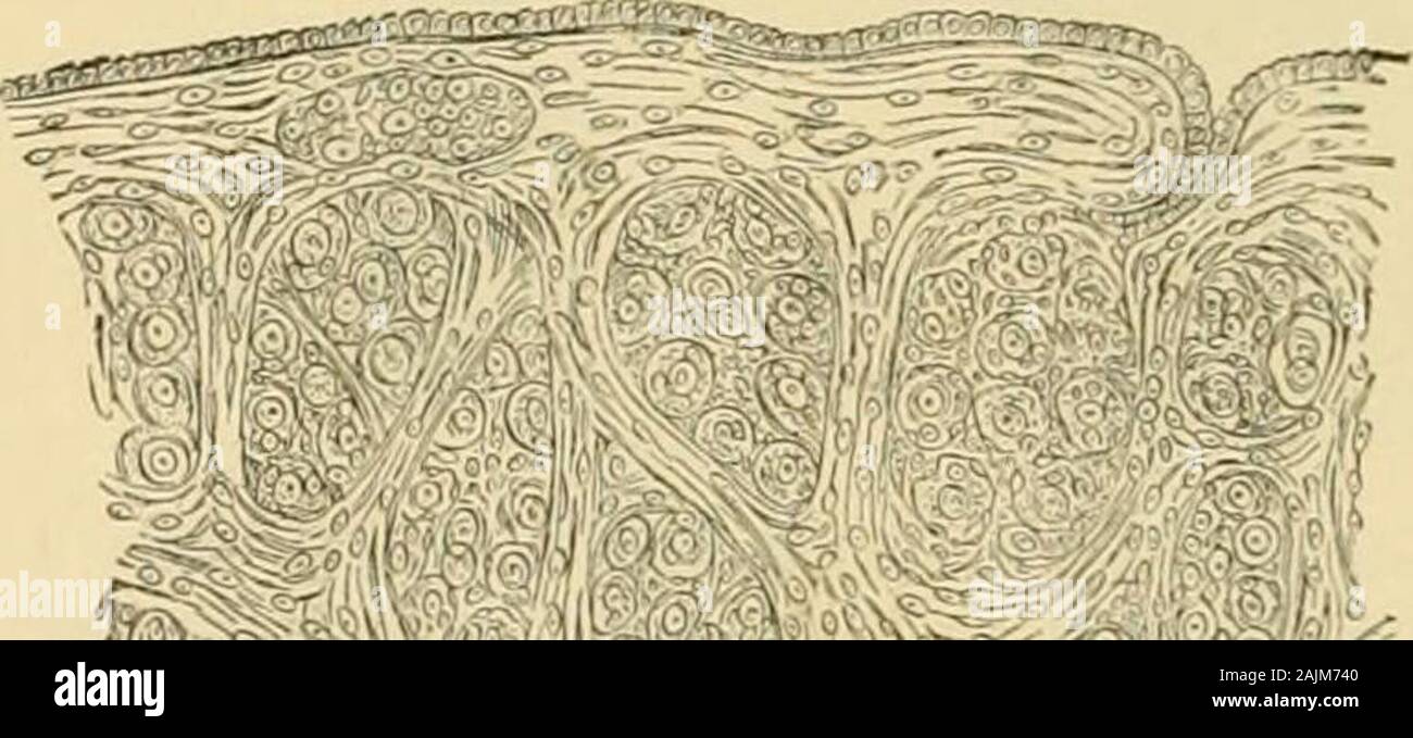 A system of gynecology . From a Foetus of thirty-six weeks. The single epithelial layer is interrupted by the intercala-tion of a belated primordial ovum with its follicular epithelial cells (Meyer). Fig. 21. Fig. 22.. Stock Photo