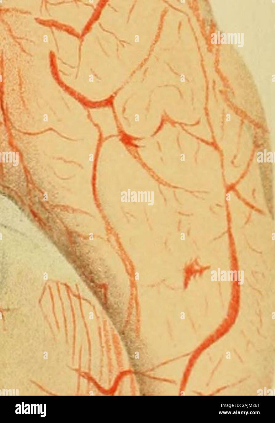 A System Of Medicine By Many Writers J Plate Iii Base Of The Brain From A Case Of P Jsterior Basic Mmiinkitis Age S Inoiitlia Iluratidu Ii Lays Theexudation Extemls As Far Forwards