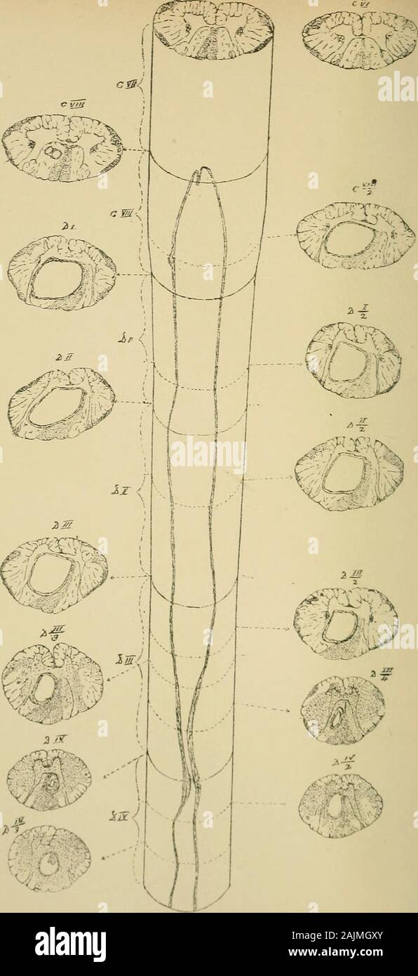 A system of medicine, by many writers; . he adjacent parts, and fades aAvay  into the normalcord, not usually haAdng a sharp boundary. Under a high  poAver of themicroscope it is seen