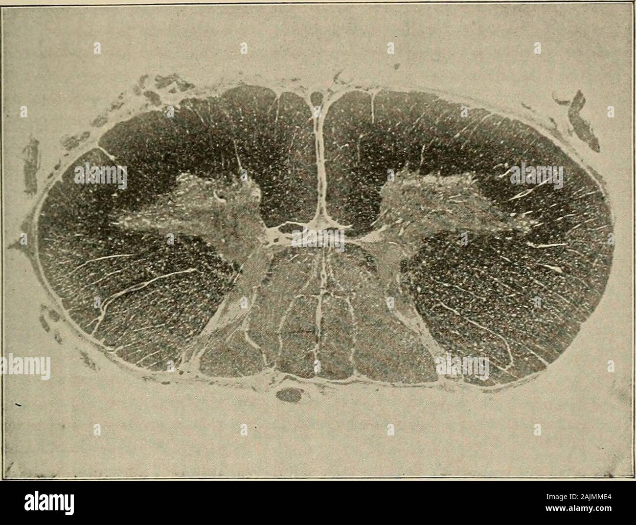 Medicine olfactory nerve hi-res stock photography and images - Alamy