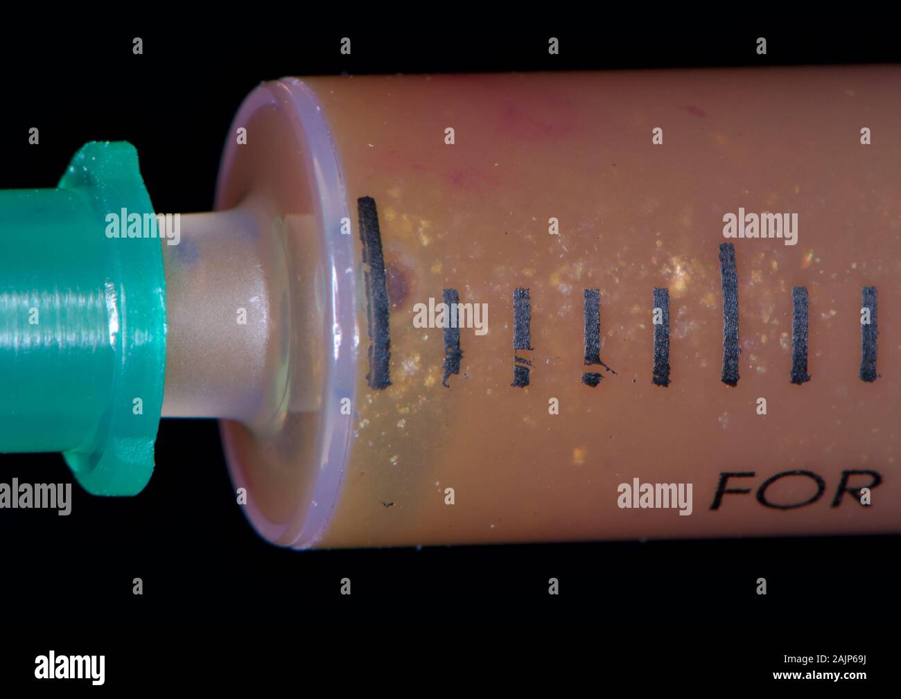 Needle aspiration of Incisive canal cyst Stock Photo Alamy