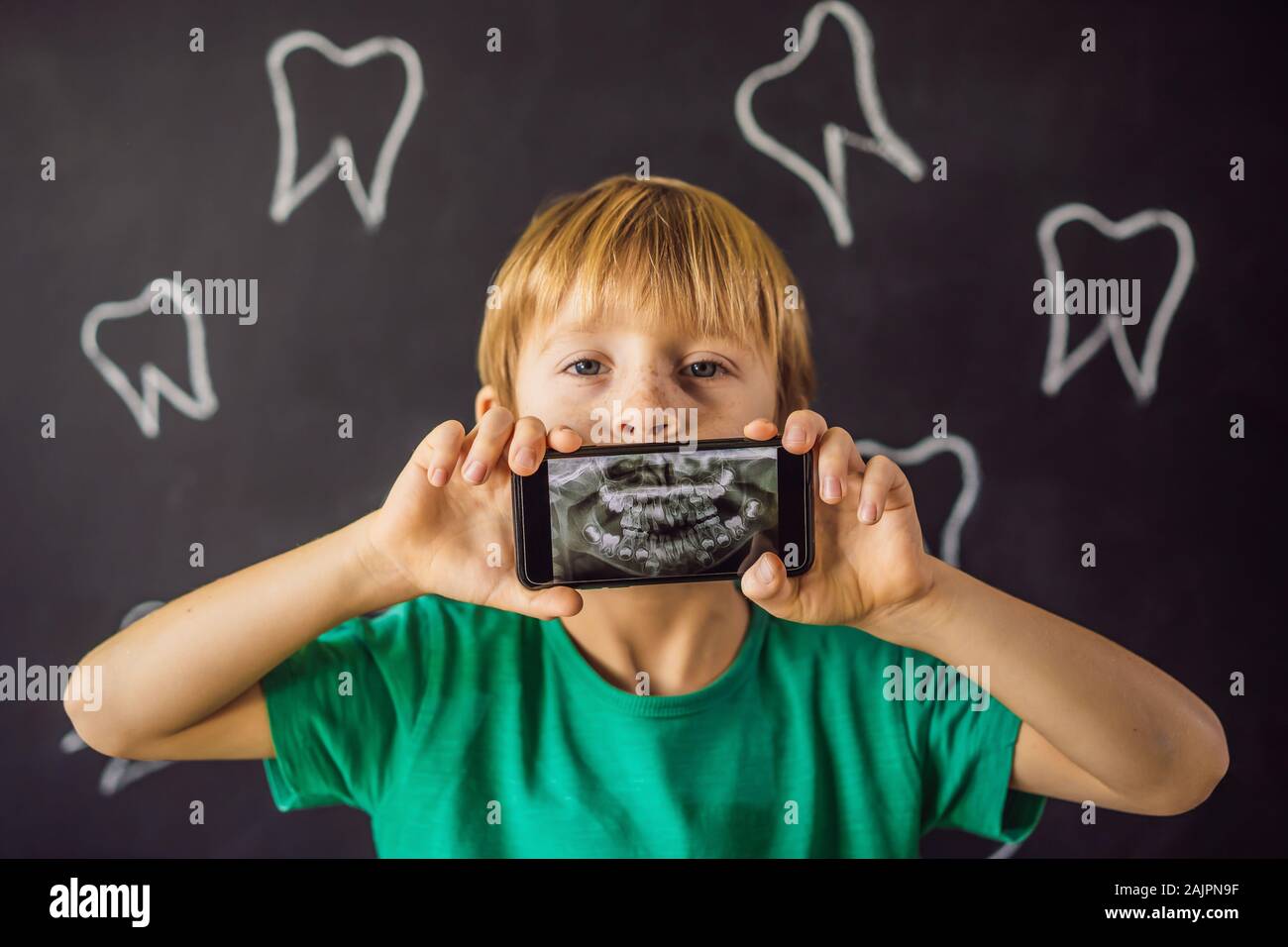 Extra tooth hires stock photography and images Alamy