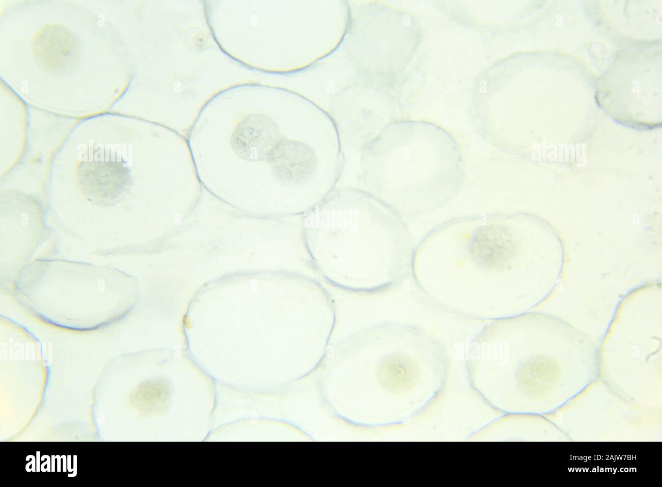 Mitosis Horse Ascaris egg under the microscope, background (Ascaris lumbricoides) Stock Photo