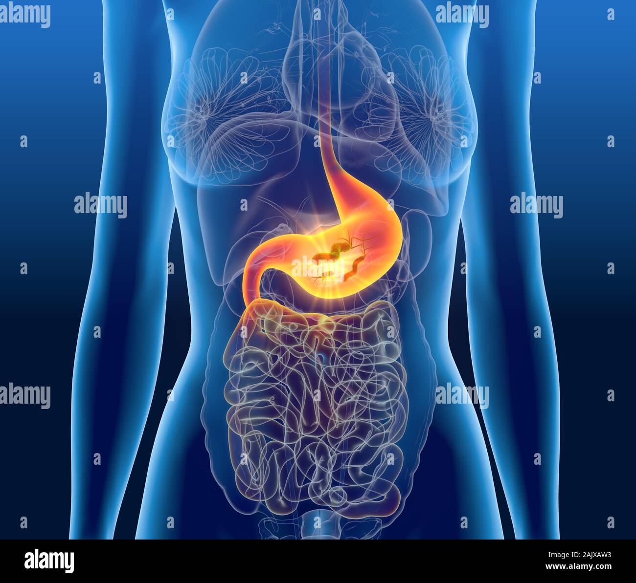 3D Illustration showing Escherichia coli bacteria (E. coli) in painful ...