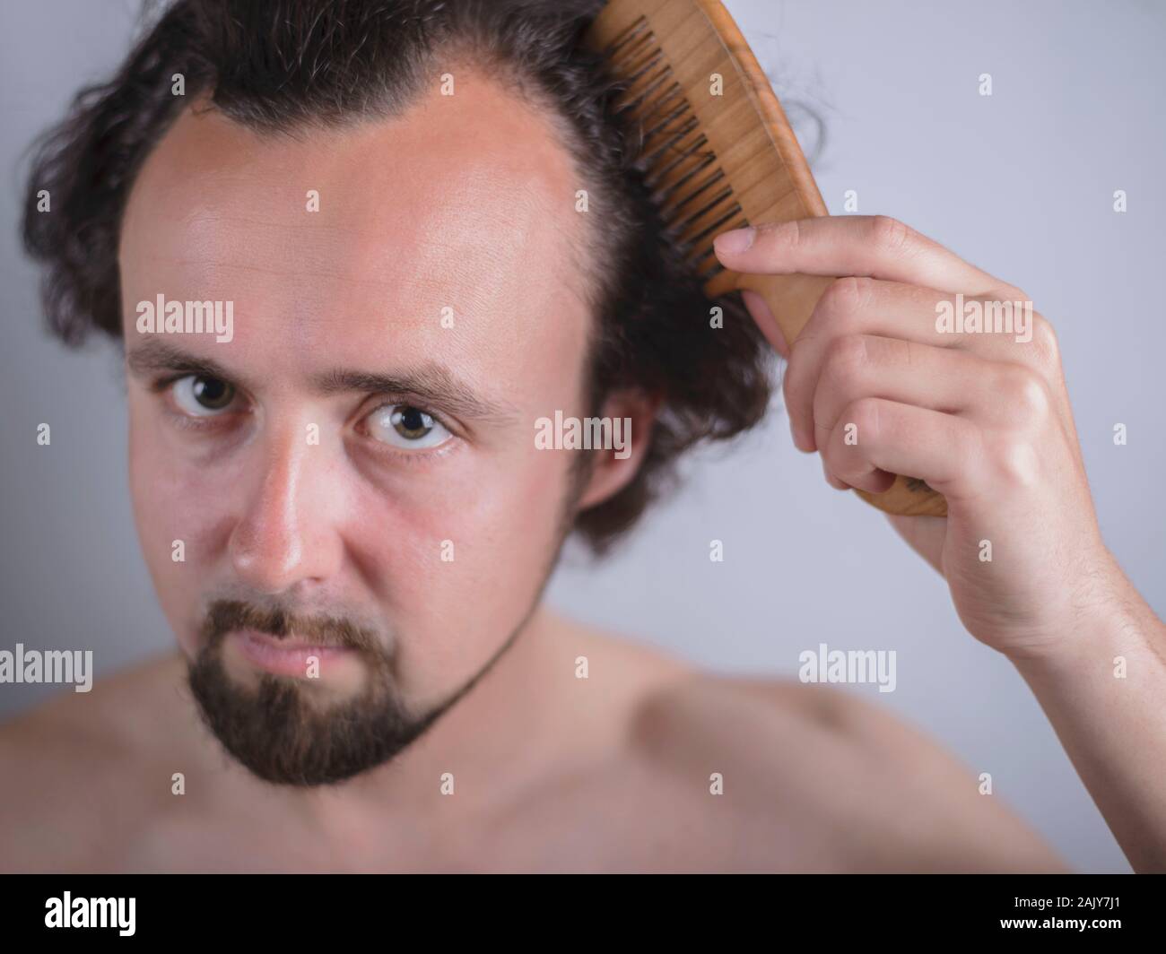 Portrait of a young guy with magnificent hair that falls early on his forehead. The problem of premature aging. Combing hair and indignantly looking i Stock Photo