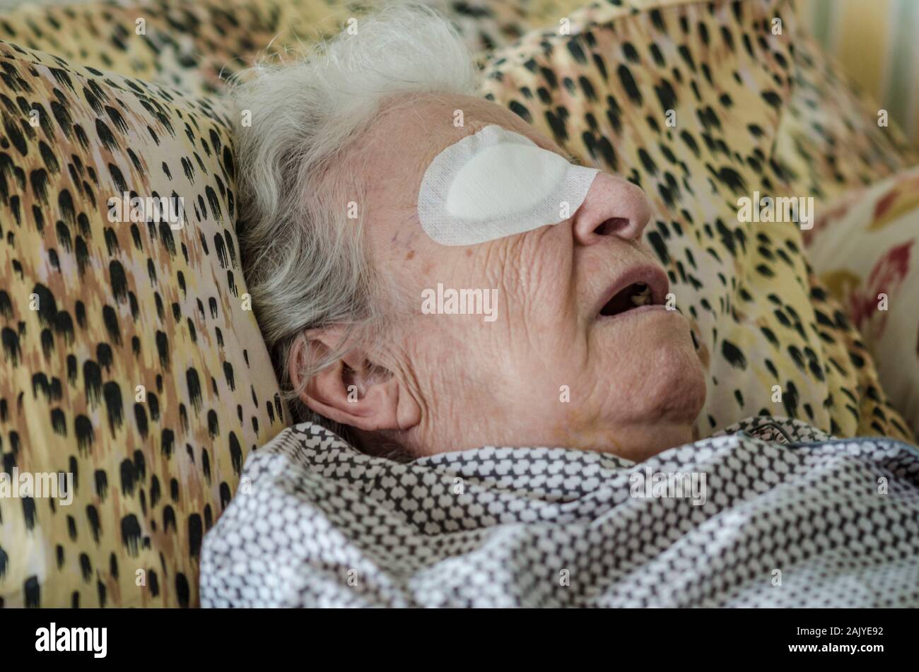 closeup of an old person with eye bandage after cataract operation Stock Photo