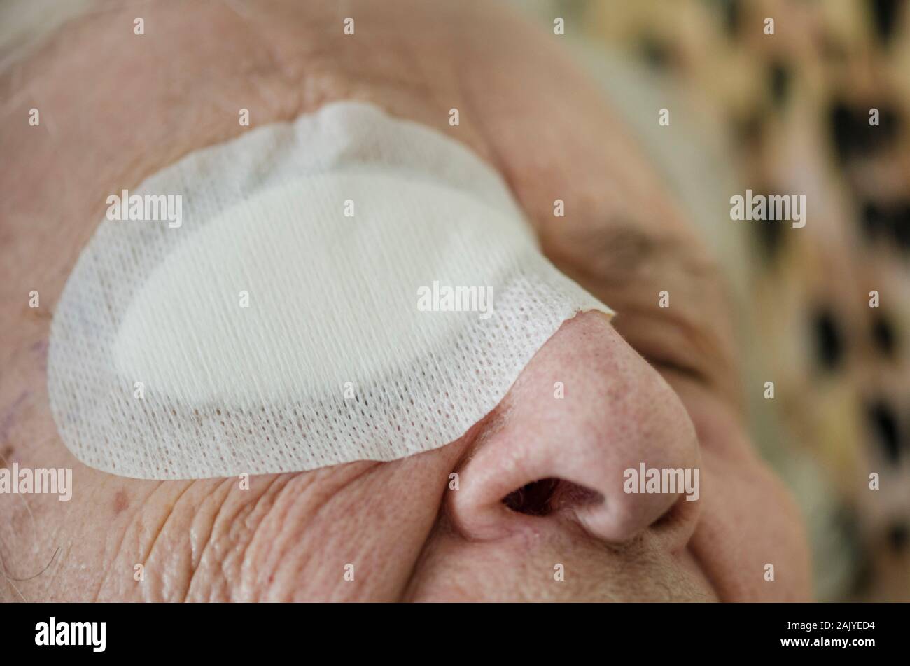 eye of an old person with bandage after cataract operation with copy space Stock Photo
