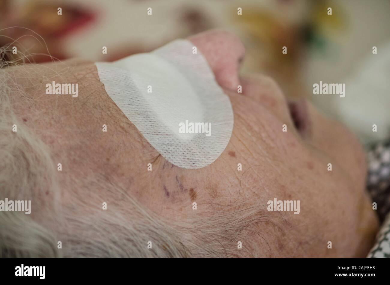 closeup eye of an old person with bandage after cataract operation Stock Photo