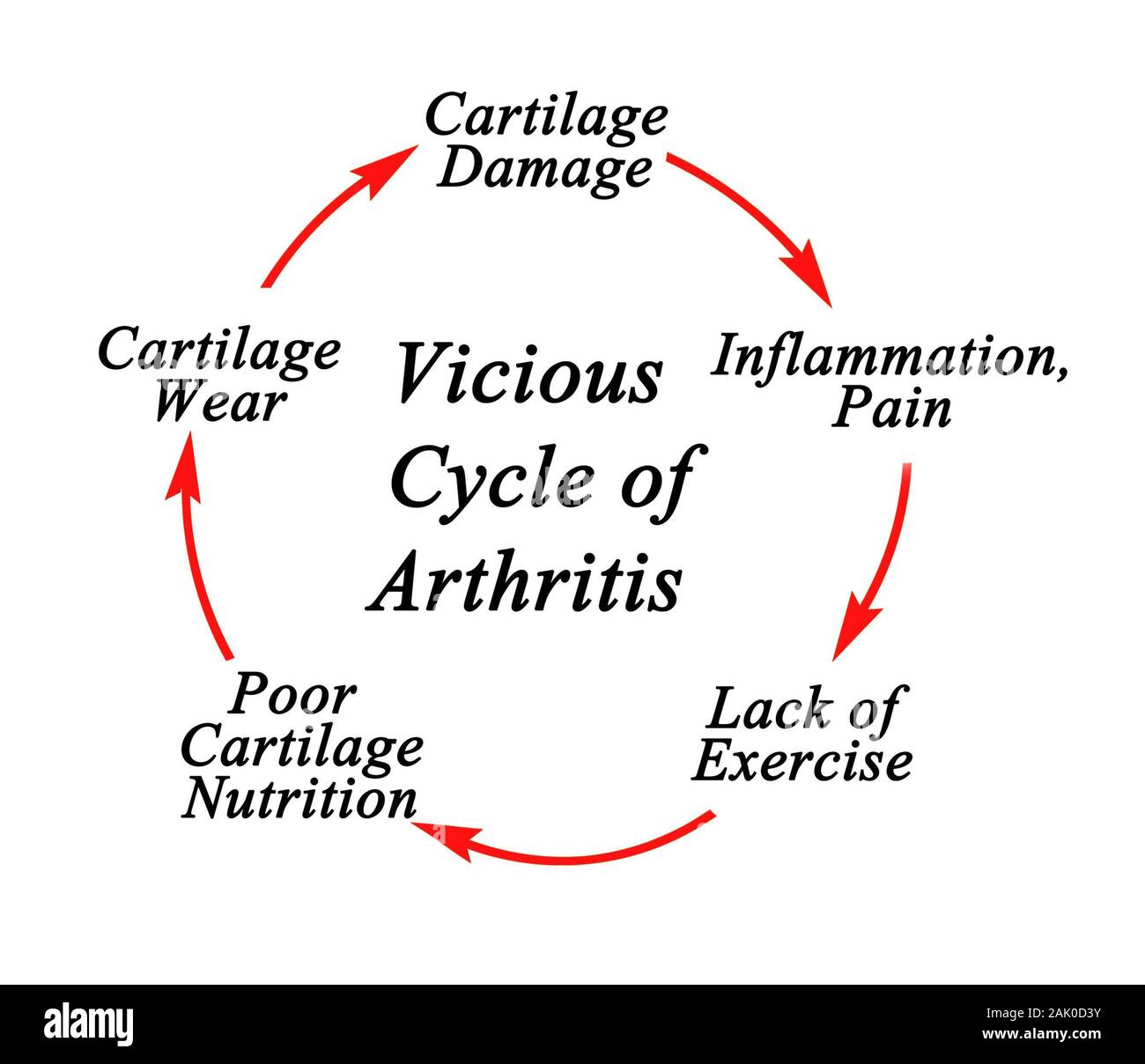 Steps in Vicious Cycle of Arthritis Stock Photo - Alamy